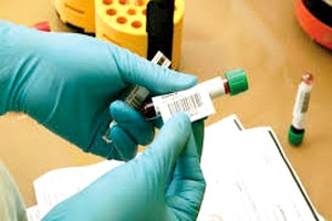 Mauritanie : le ministère de la santé rassure sur le cas de fièvre hémorragique « Crimée Congo »