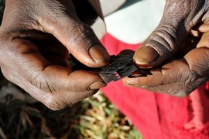 Mauritanie : le taux de prévalence de l'excision dépasse les 60%, selon des études récentes