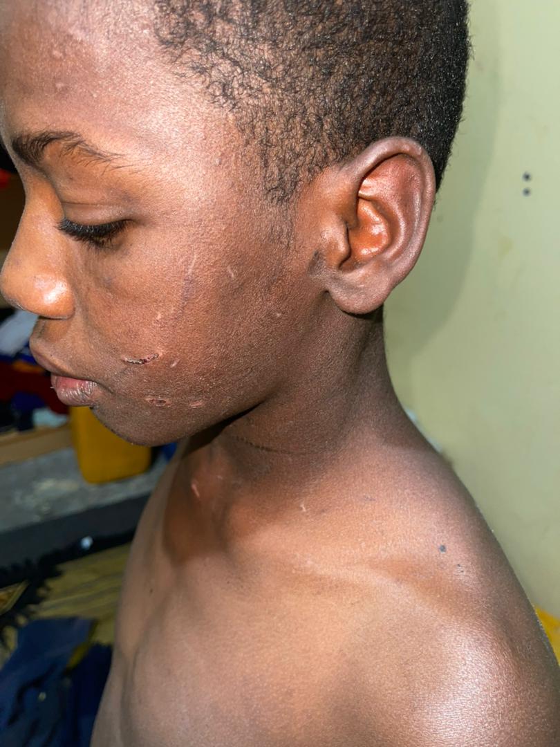 Mauritanie : Sévices sur un descendant d’esclaves, âgé de 13 ans