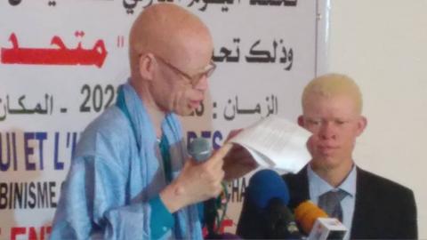 En images-Journée mondiale de sensibilisation à l’albinisme : « Tous unis pour faire entendre nos voix » 