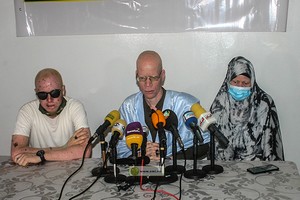 Le président de l'Association Albinos en Mauritanie : « Nous avons besoin d'une assurance maladie »
