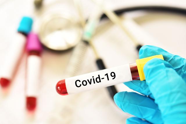 Covid-19 : 1 décès et 137 contaminations enregistrés en 24 heures