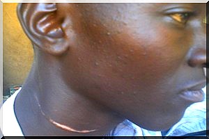 Les Mésaventures du jeune Seyibou Sylla : traumatisé à cause d’injustice des hommes en tenue 