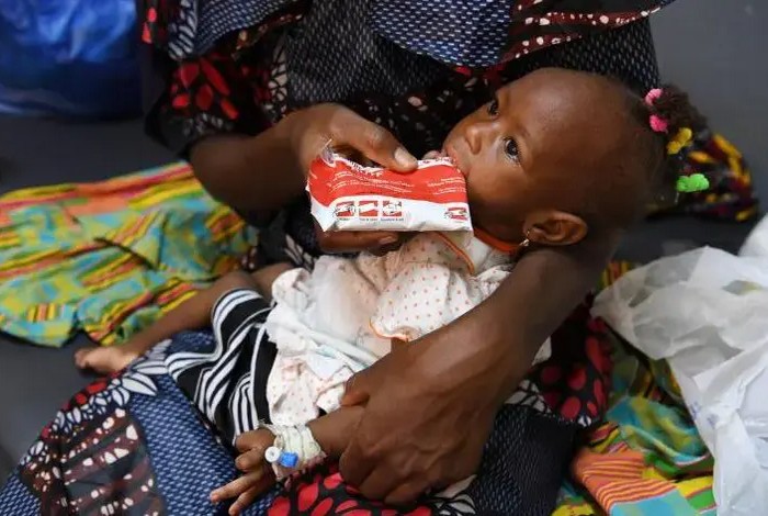 Unicef : la malnutrition menace la vie de 8 millions d’enfants dans le monde