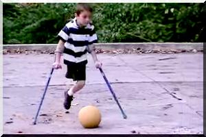 Le fabuleux destin d'un footballeur unijambiste - [Video]